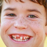 TOOTH TIMELINE